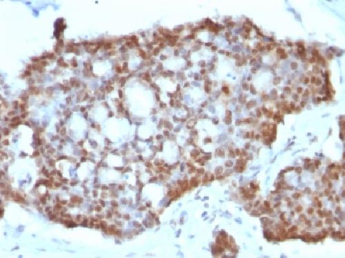 ESR2 Antibody