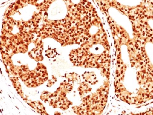 ESR2 Antibody