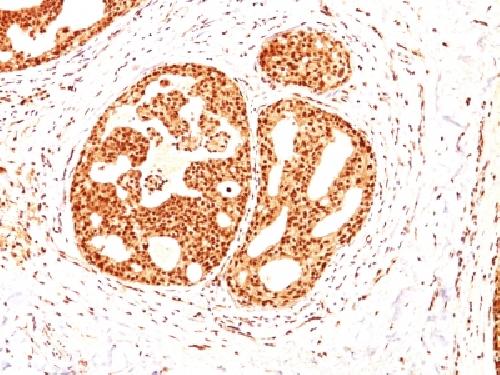 ESR2 Antibody
