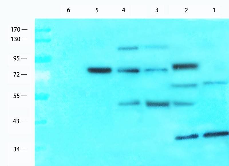 Estrogen Receptor beta 2 Rabbit Polyclonal Antibody