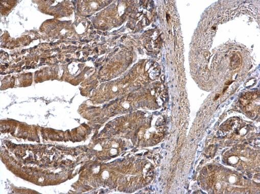 ETEA Rabbit Polyclonal Antibody