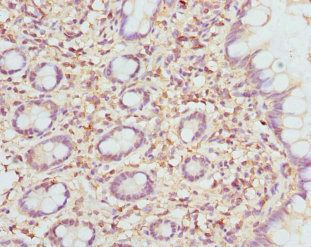 ETFDH Antibody