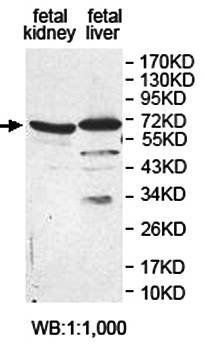 ETFDH Rabbit Polyclonal Antibody