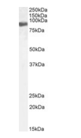 EWS/EWSR1, Biotinylated Antibody