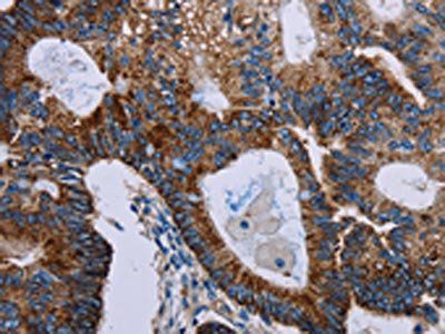 F11R Antibody