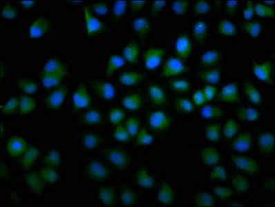 F13A1 Antibody