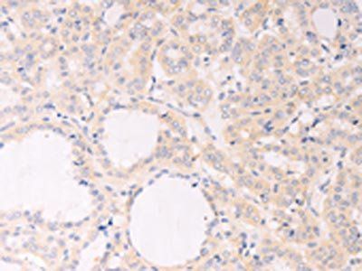 F7 Antibody