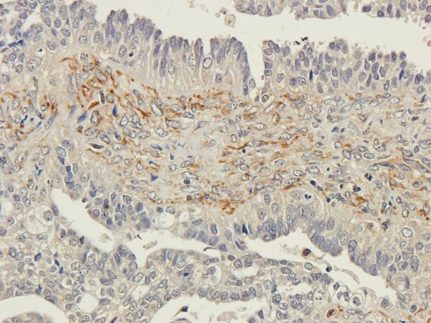 FAAH Rabbit Polyclonal Antibody