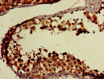 FAAH Antibody