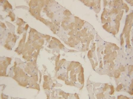 Cardiac FABP/FABP3 Rabbit Polyclonal Antibody