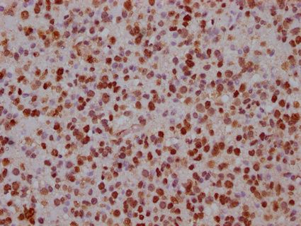 FABP4 Antibody