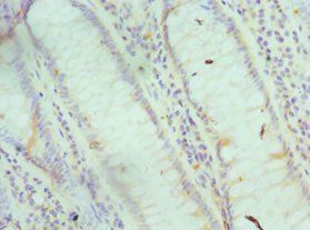 FABP6 Antibody