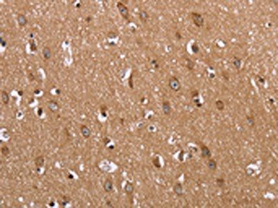 FABP6 Antibody