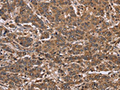 FABP6 Antibody