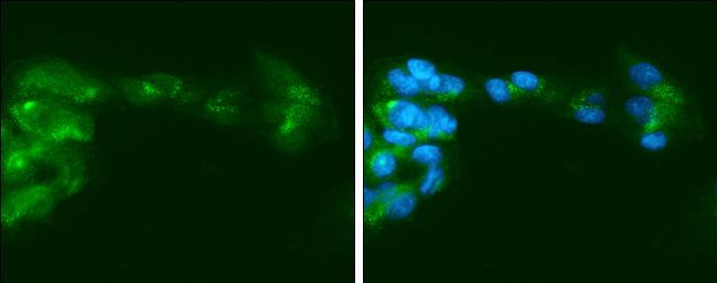 Factor IX Rabbit Polyclonal Antibody