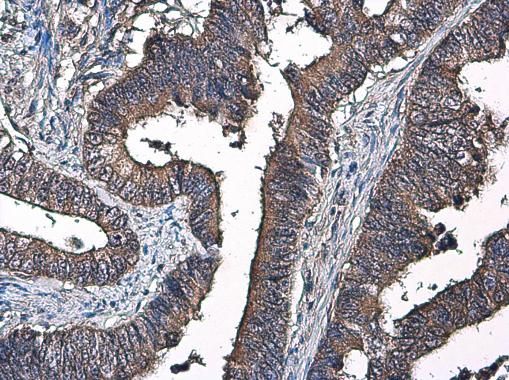 Factor IX Rabbit Polyclonal Antibody