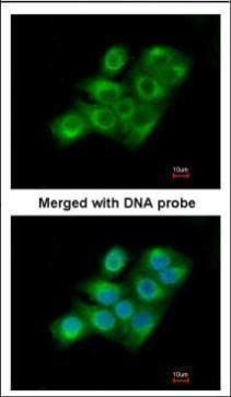 Factor XIIIa Rabbit Polyclonal Antibody