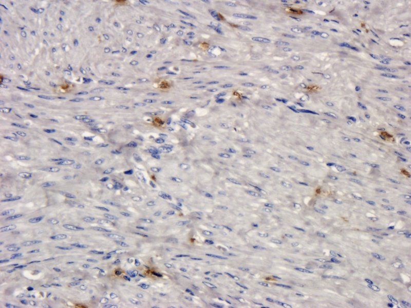 Factor VIII Rabbit Polyclonal Antibody