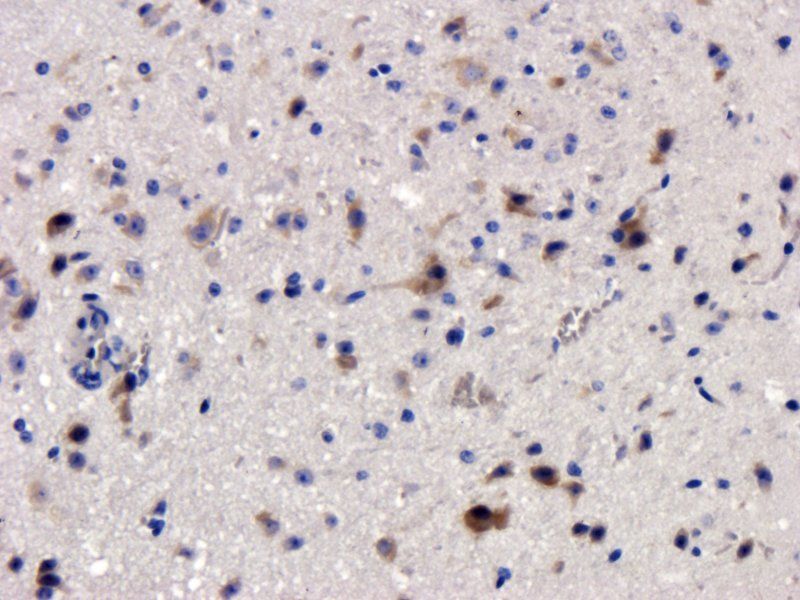 Factor VIII Rabbit Polyclonal Antibody