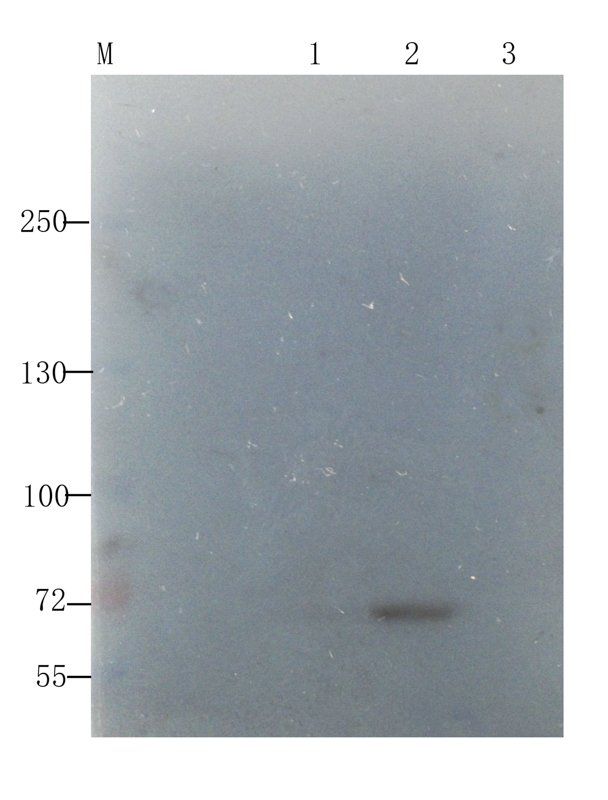 Factor VIII Rabbit Polyclonal Antibody