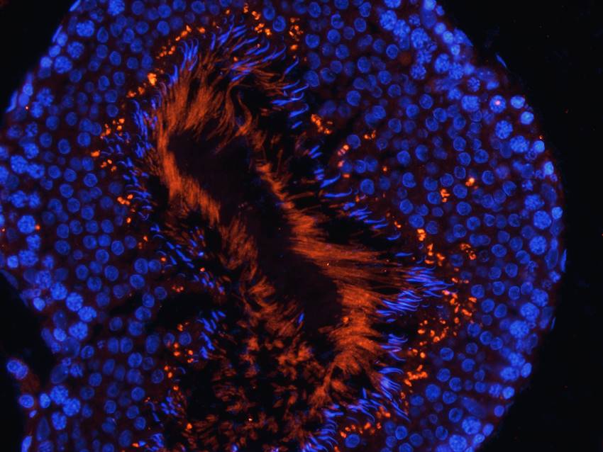 Factor VIII Rabbit Polyclonal Antibody