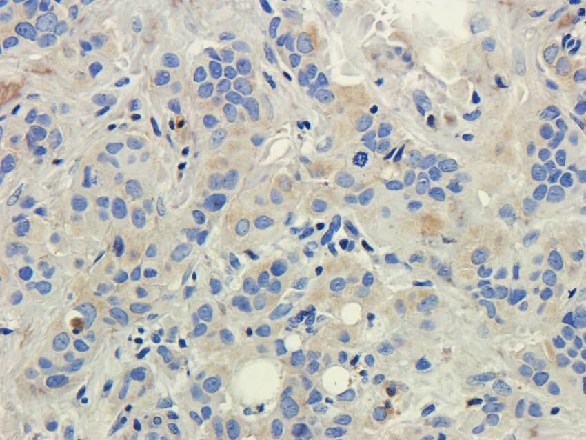 Factor VIII Rabbit Polyclonal Antibody