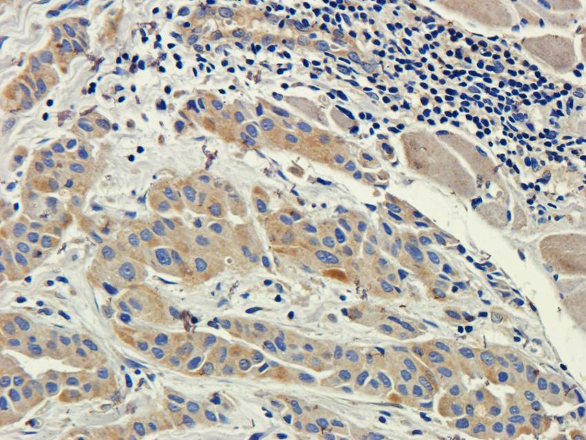 Factor VIII Rabbit Polyclonal Antibody