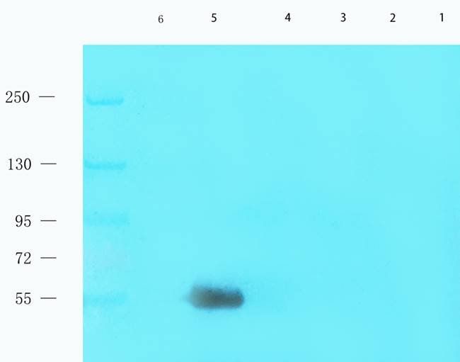 Factor VIII Rabbit Polyclonal Antibody