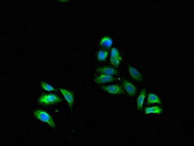FADS1 Antibody
