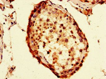 FAF1 Antibody