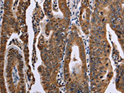 FAF1 Antibody