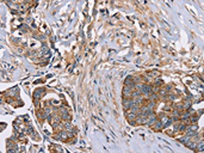 FAIM2 Antibody