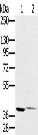 FCMR Antibody