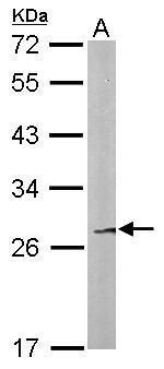 FAM122B Rabbit Polyclonal Antibody