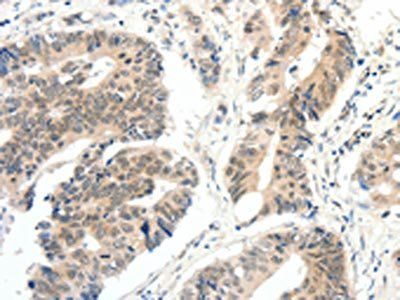 FAM3A Antibody