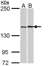 FANCA Rabbit Polyclonal Antibody