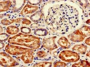 FANCC Antibody