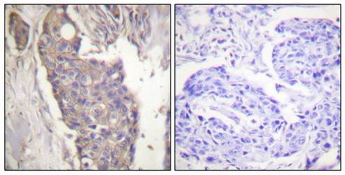 FAS Antibody