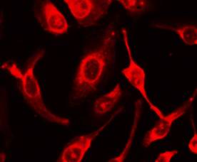 Fas Rabbit Polyclonal Antibody