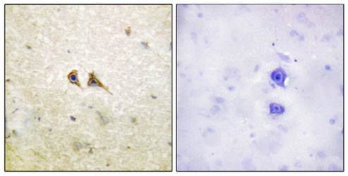 FAS ligand Antibody