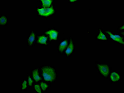FASN Antibody