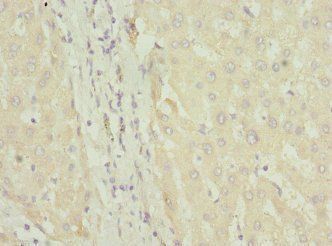 FASTK Antibody