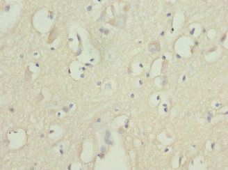 FASTK Antibody