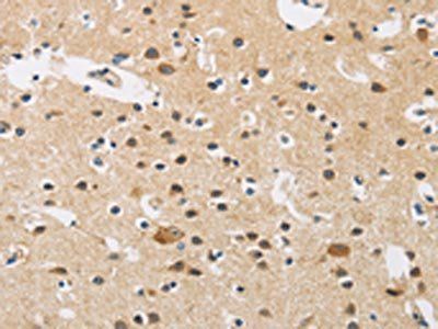 FASTK Antibody