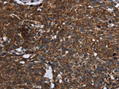 FASTKD2 Antibody