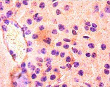 FABP3 Antibody