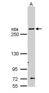 Fatty Acid Synthase Rabbit Polyclonal Antibody