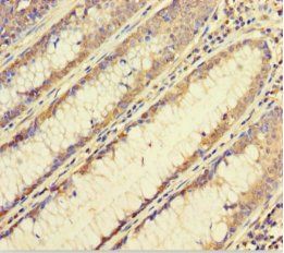 FBXL17 Antibody