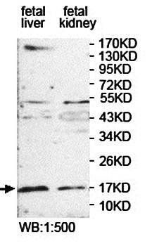 FBXL21 Rabbit Polyclonal Antibody