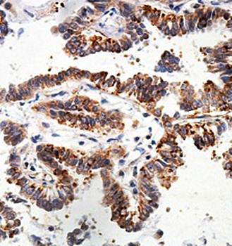 FBXL21 Rabbit Polyclonal Antibody